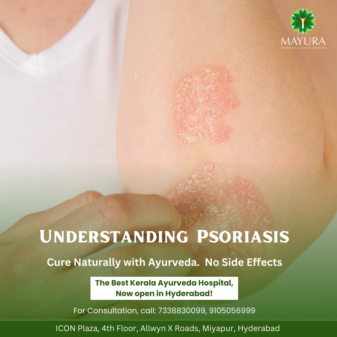 Psoriasis