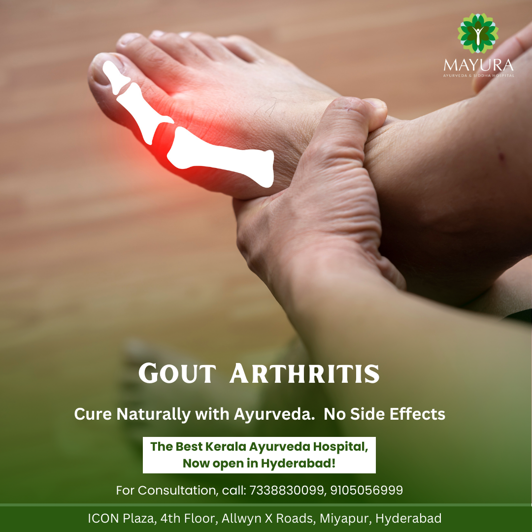 Gout Arthritis